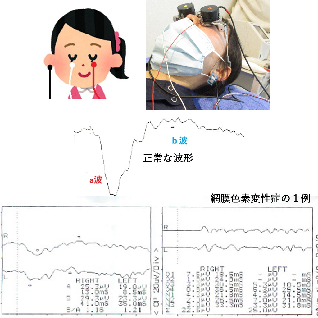 検査機器｜南東北眼科クリニック