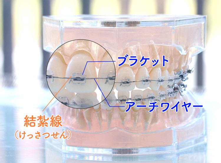 勉強会：フルパッシブ矯正について