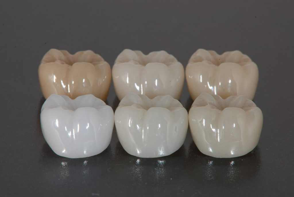 フルジルコニア フレームの進化 - 歯科技工所 株式会社ファインデンタル