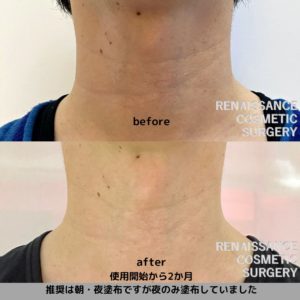 木谷ドクターブログ｜ルネッサンス美容外科医院