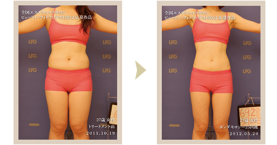 エンダモロジーインテグラル｜プエラルボビューティーサロン CACHE・CACHE