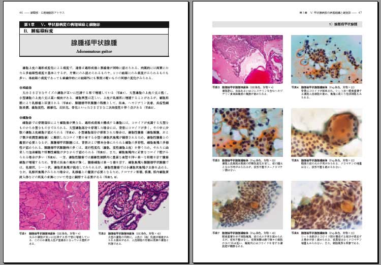 頭頸部・口腔細胞診アトラス