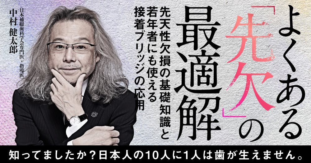 歯に優しいけどムズかしい、接着ブリッジの臨床論。デザイン・形成の