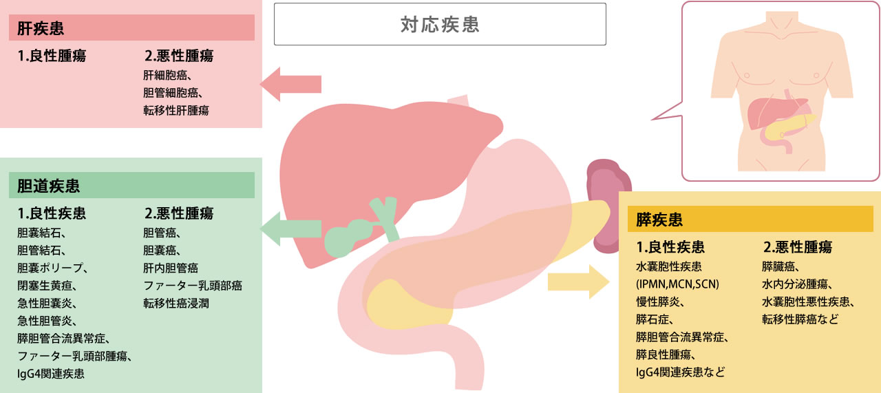 肝胆膵専門外来 – 津田沼中央総合病院