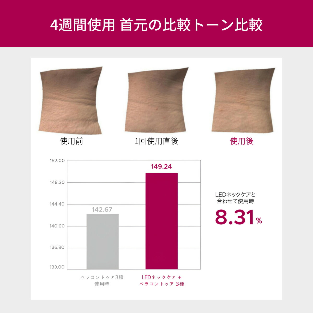 楽天市場】【首専用美顔器】 首のシワ 首のたるみ VリフトLED