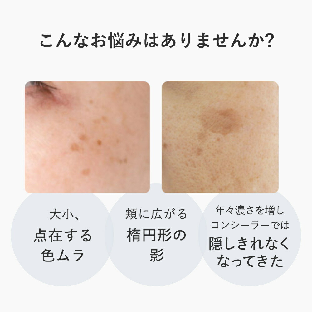 楽天市場】アンプルール公式【スポット集中美容液】『クリアコンセント