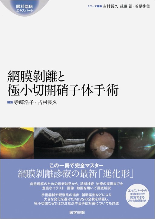 楽天市場】小切開硝子体手術の通販