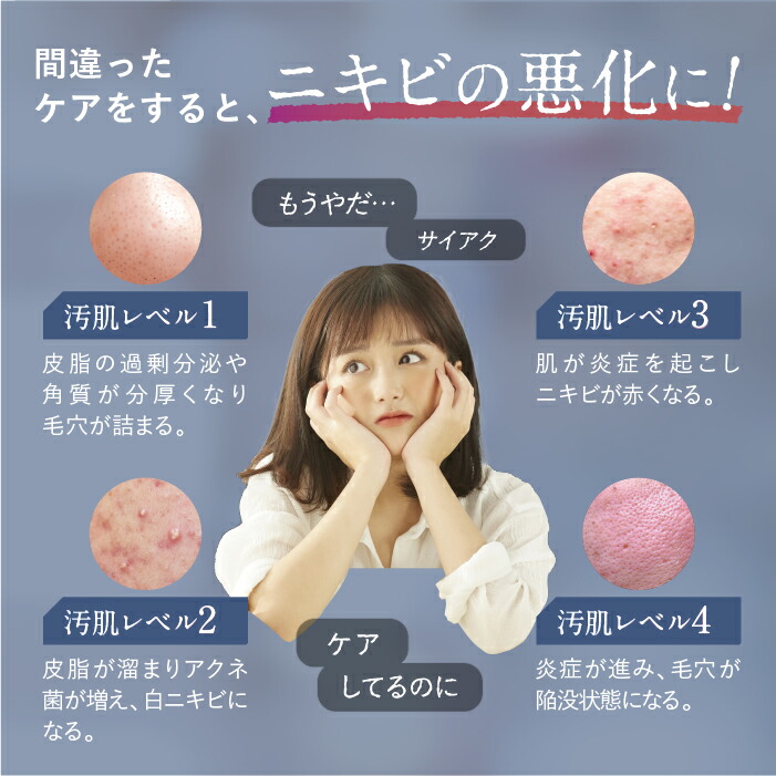 楽天市場】☆【 公式 】 トワニエール imuJelly イミュゼリー 150g