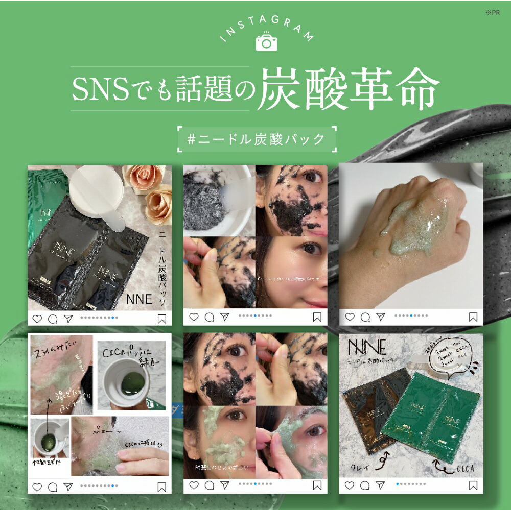 楽天市場】【話題の炭酸パック！】NNEニードル炭酸パック NNE ニードル