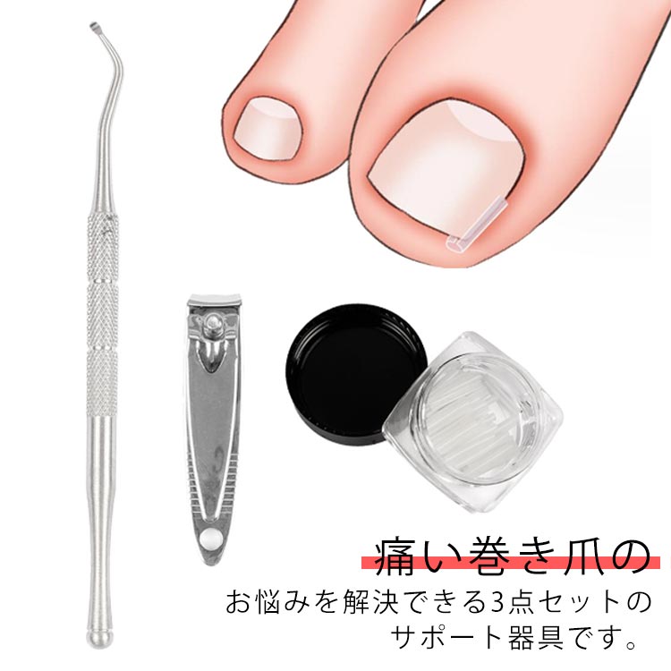 楽天市場】 陥入爪 ゾンデ付 巻き爪ガード 巻き爪 3点セット 爪垢取り