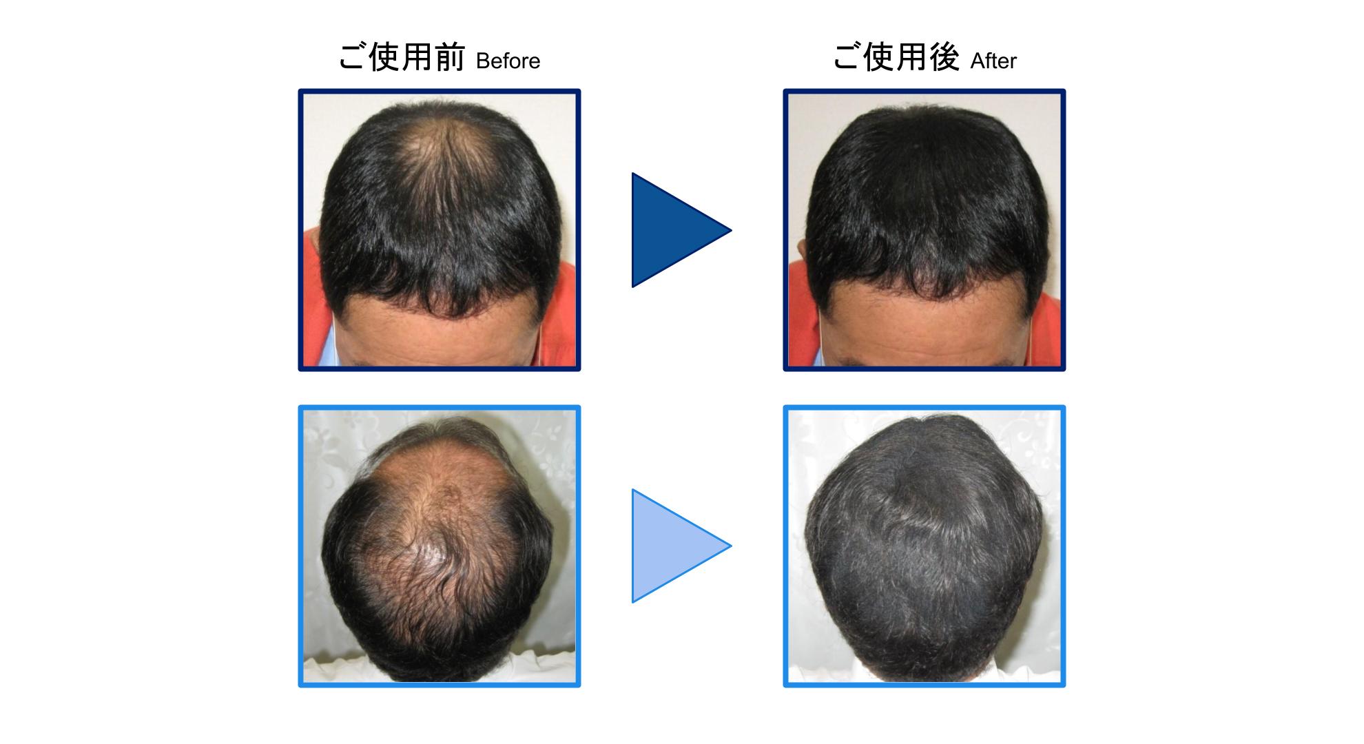 ティップトップ|植物性の頭皮にもやさしい増毛パウダー