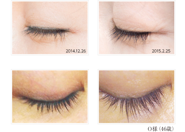 まつげ美容液coboアイラッシュ｜ヘアケア専門店レフィーネ公式