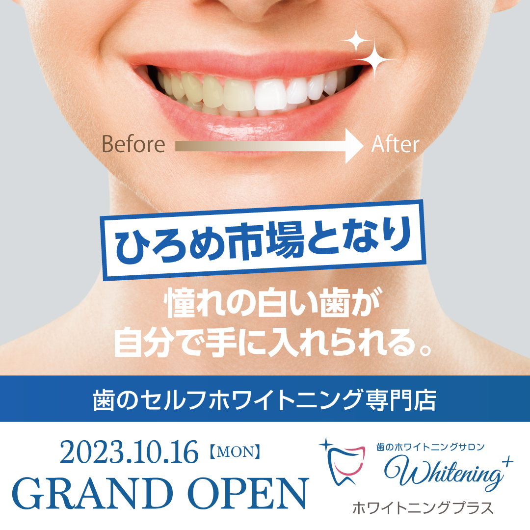 ホワイトニングプラス高知 | 憧れの白い歯が自分で手に入れられる。