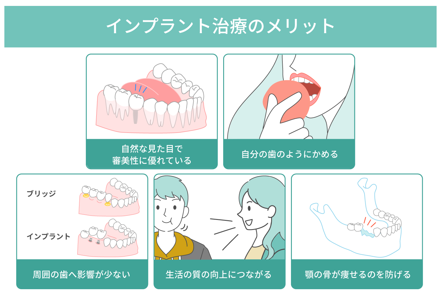 インプラント治療のメリット・デメリット、起こり得るトラブルについて