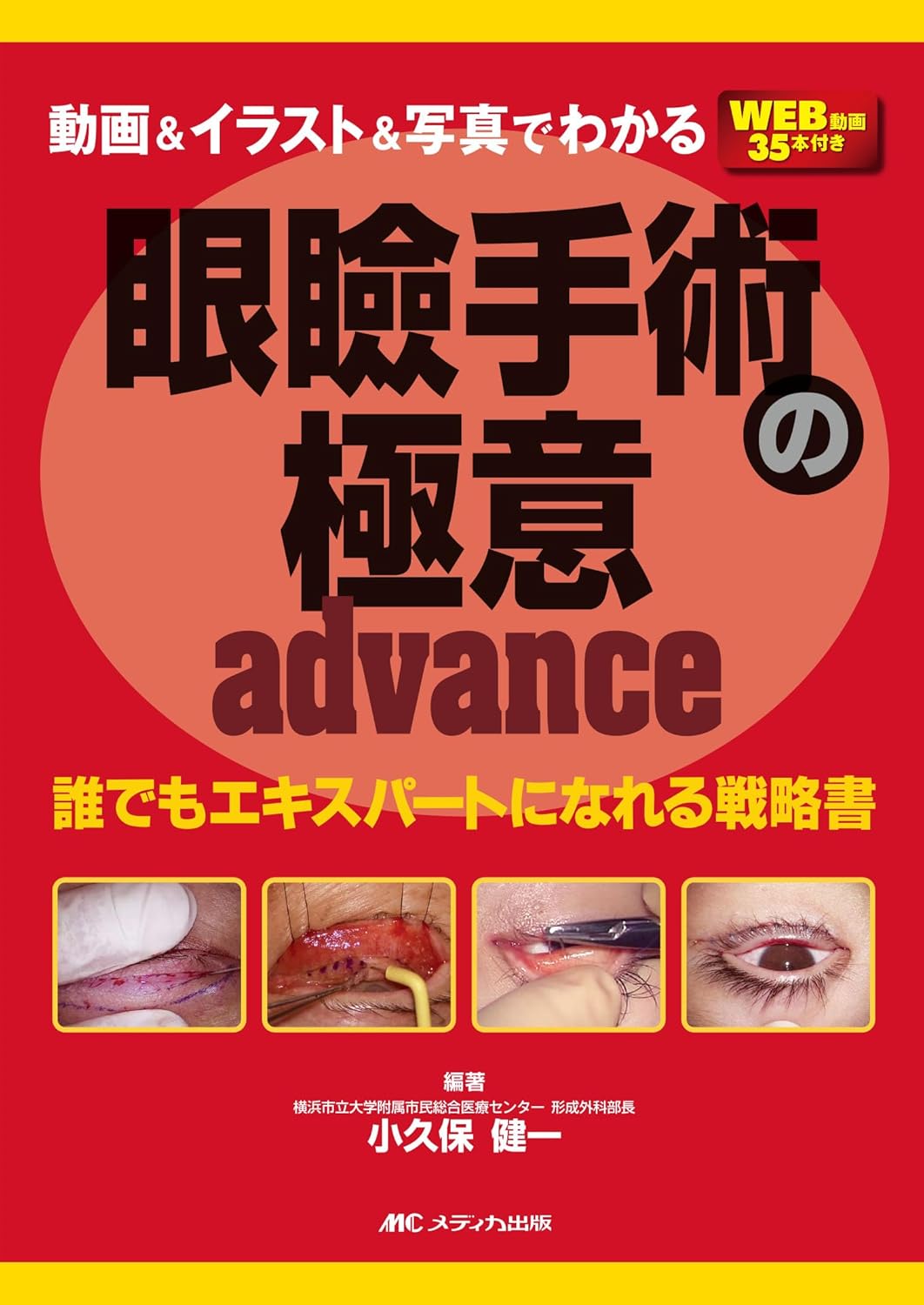 動画＆イラスト＆写真でわかる 眼瞼手術の極意 advance - 眼科専門書店