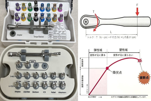 インプラント170種類の「補綴時締結トルク値とドライバー」について