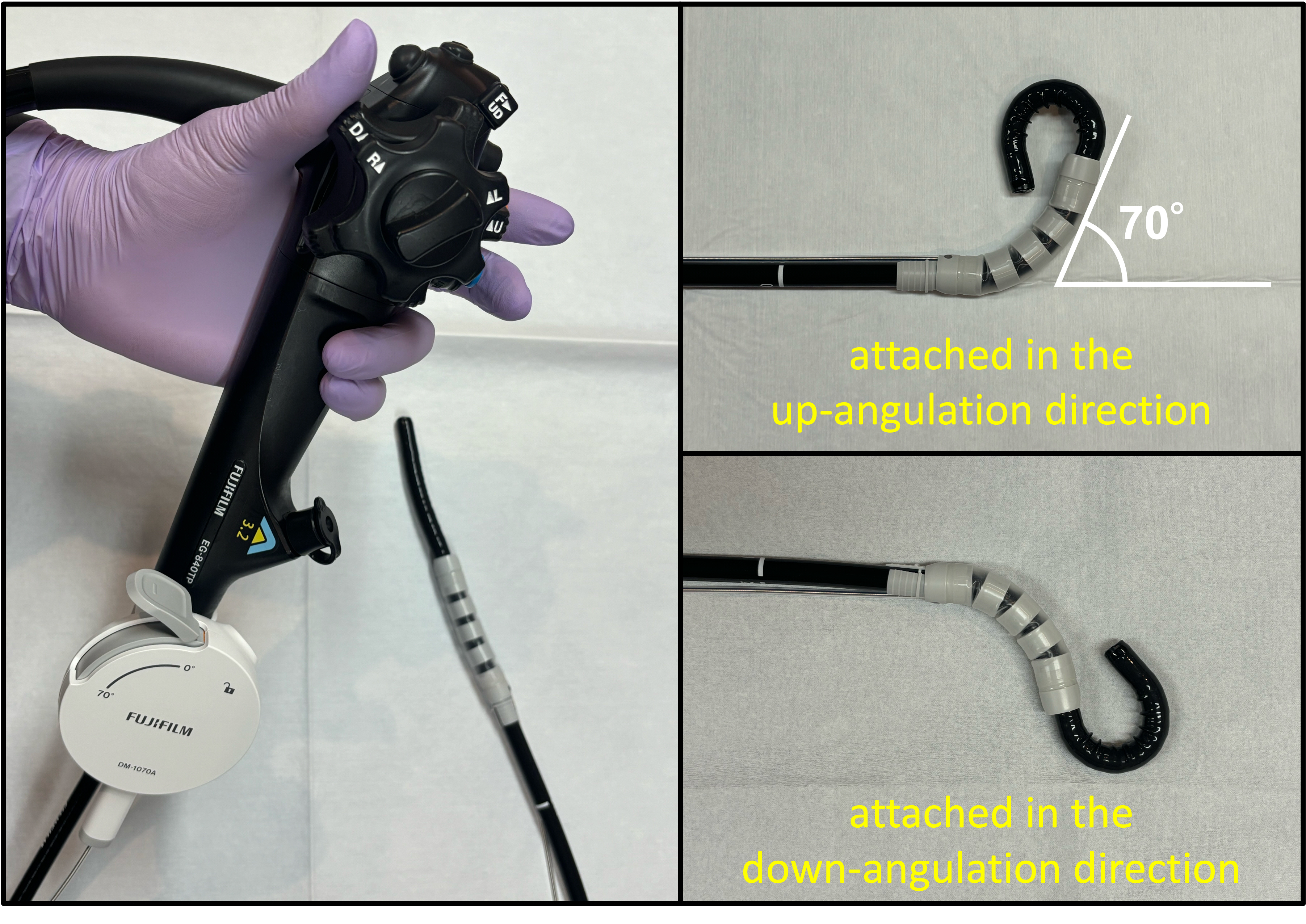 Successful gastric endoscopic submucosal dissection using an