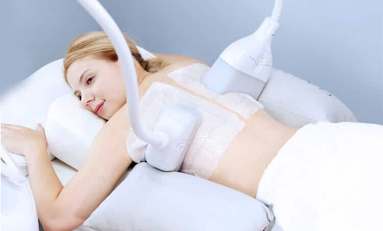 脂肪冷却マシンの種類を解説！長く愛用できる痩身マシンを選ぶポイント