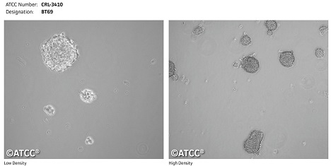 ATCC®の神経細胞株 | ATCC® Neural Cell Lines | フナコシ
