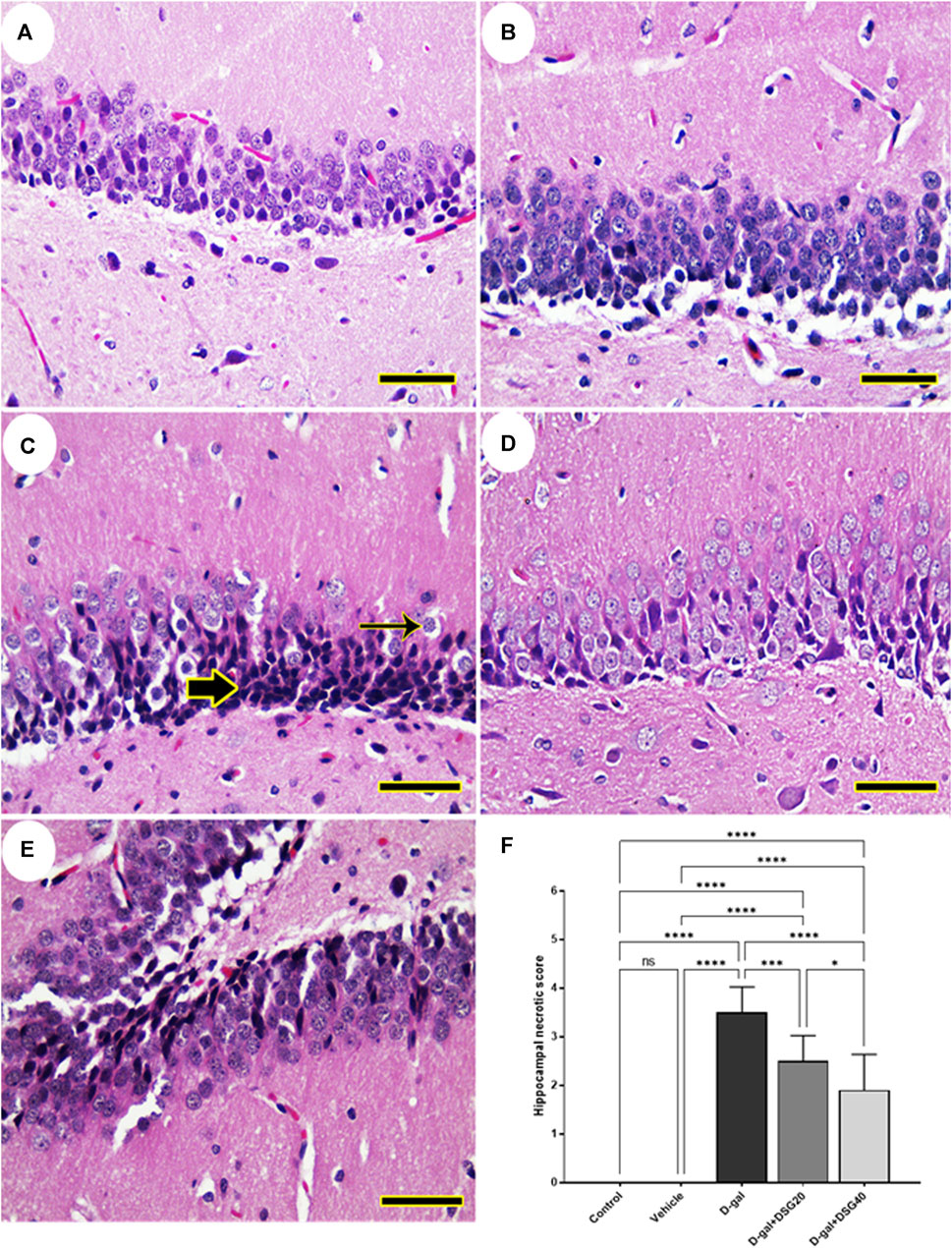 Frontiers | Diosgenin alleviates D-galactose-induced oxidative
