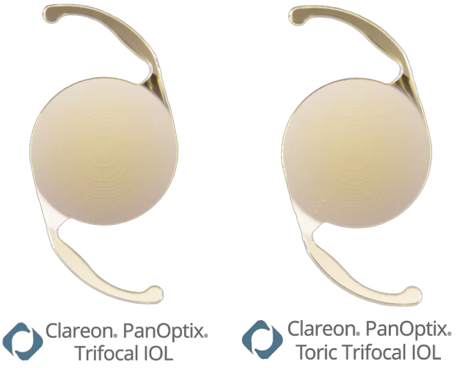 多焦点眼内レンズについて｜経堂こうづき眼科-世田谷区経堂駅直結 経堂