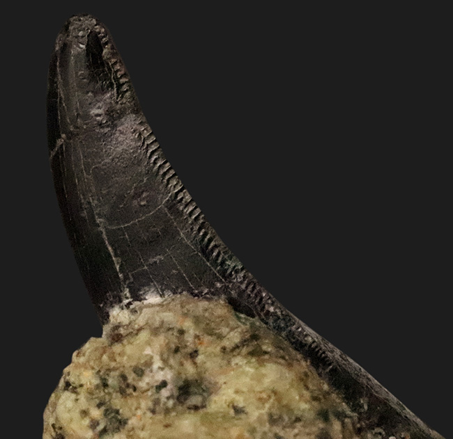 10数年の時を経て、ついに公開！トップクオリティ……漆黒のエナメル質を