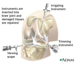 膝関節鏡手術について - 整形外科で疑問に思ったら - 整形外科 - 栗山