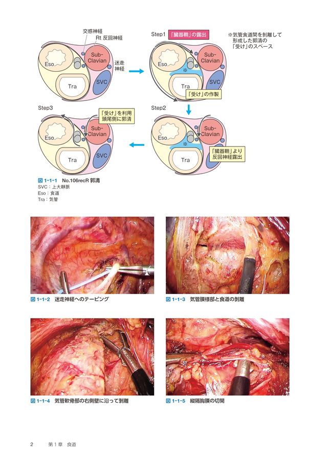 消化器内視鏡外科手術バイブル_立読み
