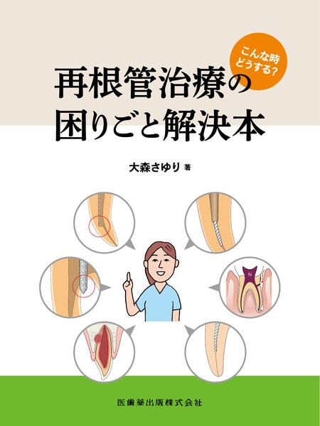 こんな時どうする？ 再根管治療の困りごと解決本／医歯薬出版株式会社
