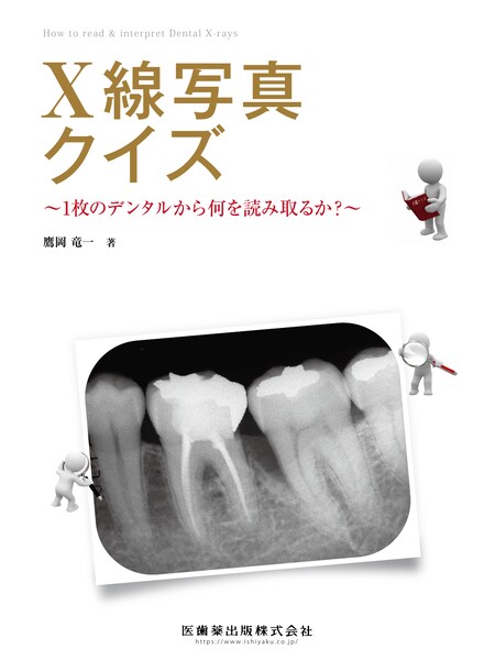 歯科用小型X線CTによる3次元画像診断と治療 CD－ROM付／医歯薬出版株式会社