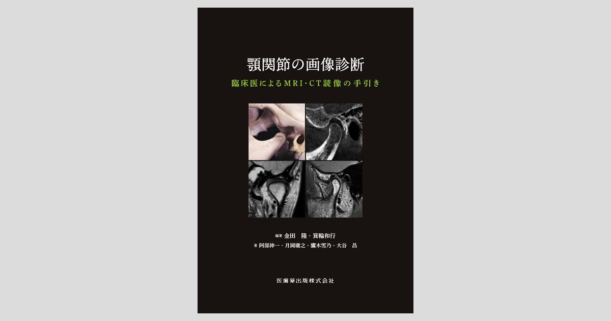 顎関節の画像診断 臨床医によるMRI・CT読像の手引き／医歯薬出版株式会社