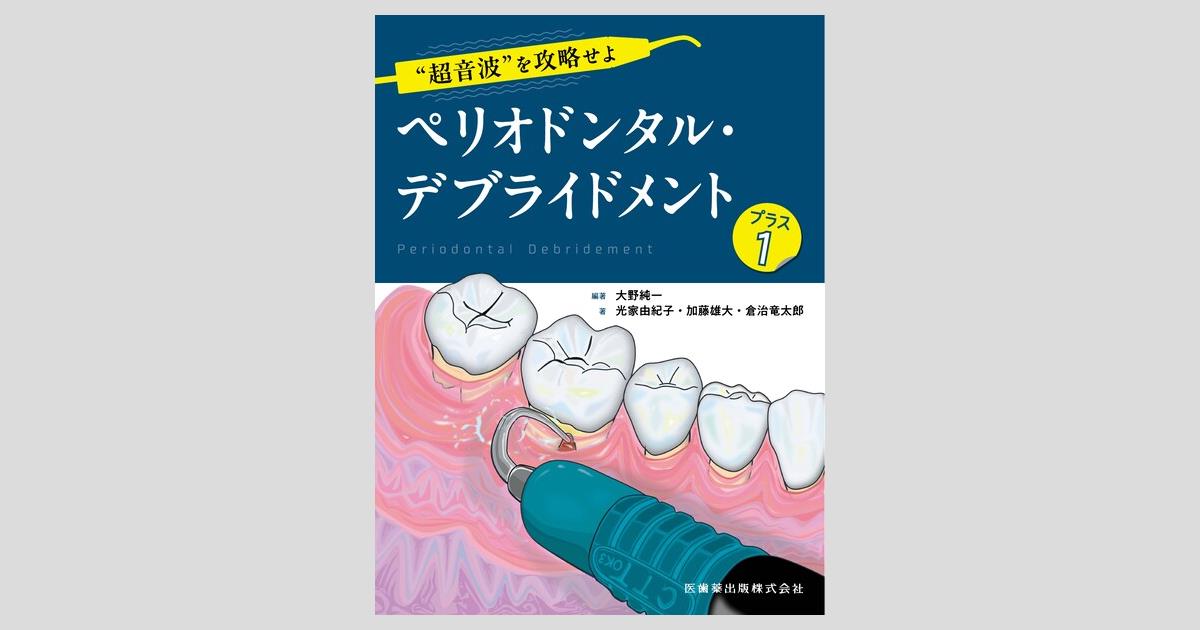超音波”を攻略せよ ペリオドンタル・デブライドメント プラス1／医歯薬