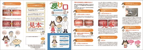 ムーシールド〔反対咬合用〕S・M《在庫限り》 | 株式会社 JM Ortho