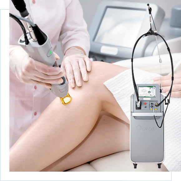 ジェントルマックスプロ | 熱破壊式の医療脱毛ならジョウクリニック