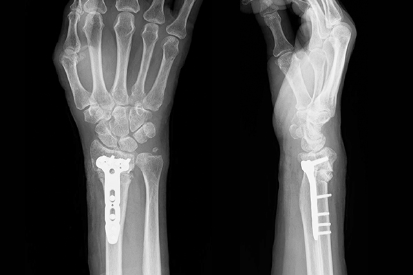 疾患解説 手外科センター - 医療法人財団 荻窪病院（東京都 杉並区）