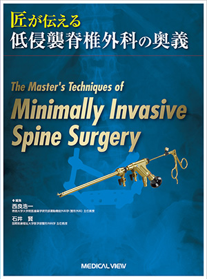 メジカルビュー社｜整形外科｜新OS NEXUS No.3 ベーシックな脊椎除圧術