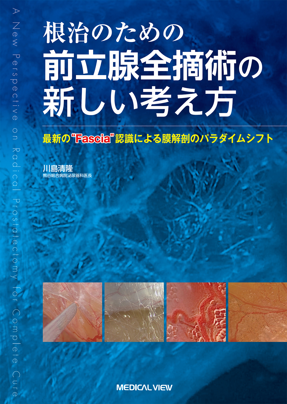 メジカルビュー社｜泌尿器科｜根治のための前立腺全摘術の新しい考え方