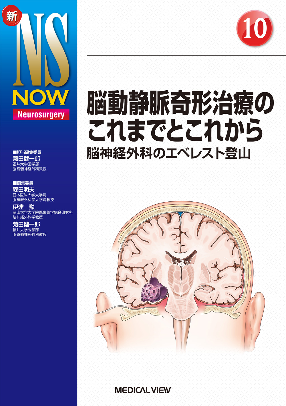 メジカルビュー社｜脳神経外科｜新NS NOW 10 脳動静脈奇形治療のこれ