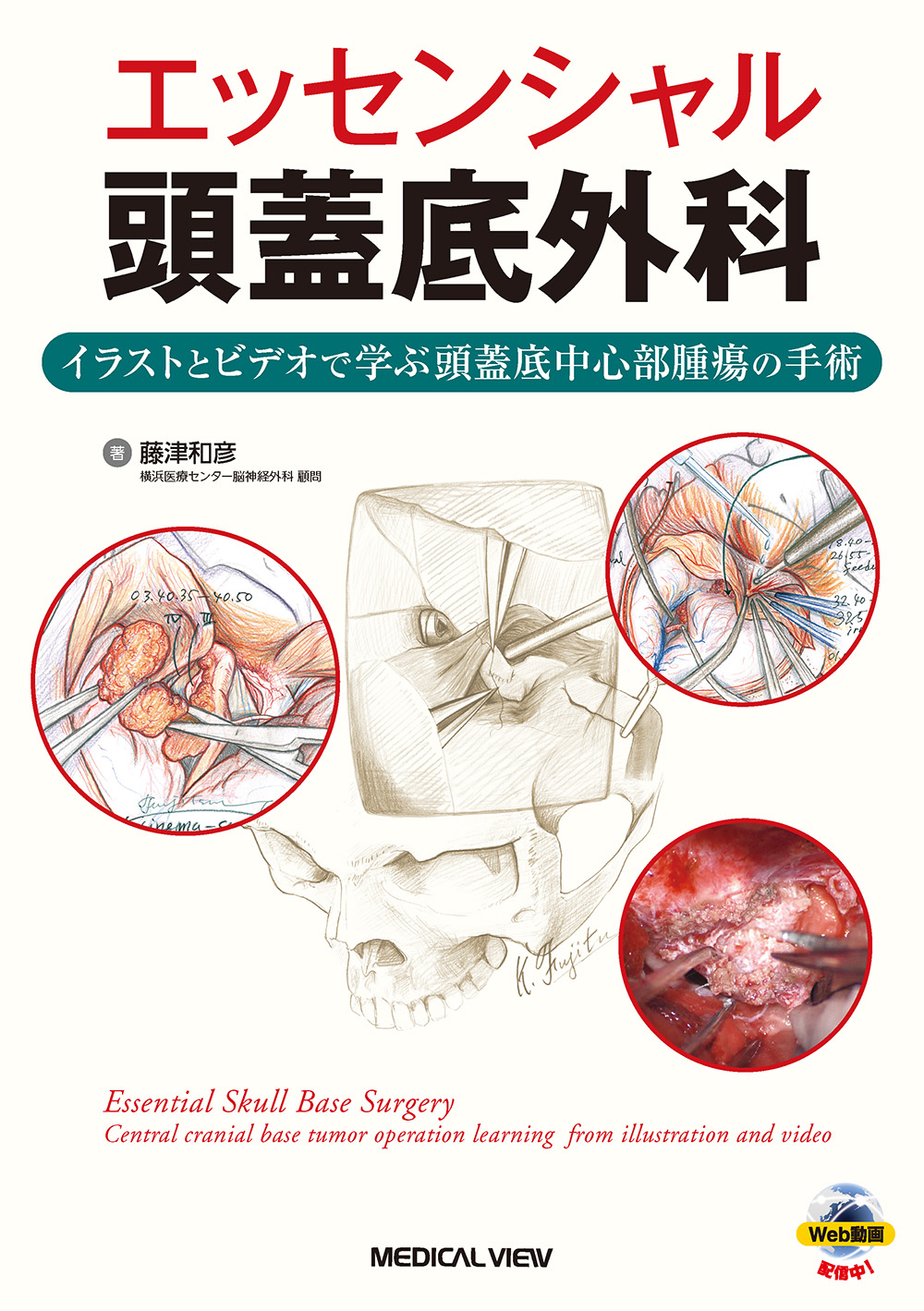 メジカルビュー社｜脳神経外科｜エッセンシャル頭蓋底外科［Web動画付］