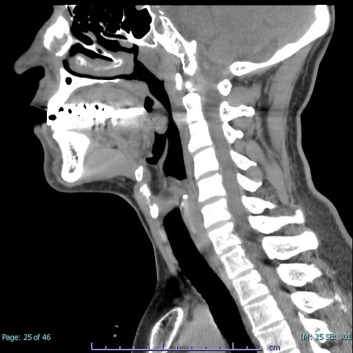 頭頸部のファーストチョイス｜MRI・CTのファーストチョイス｜医師の方