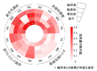 複数の精神疾患に共通する大脳白質の異常を発見 統合失調症と双極性