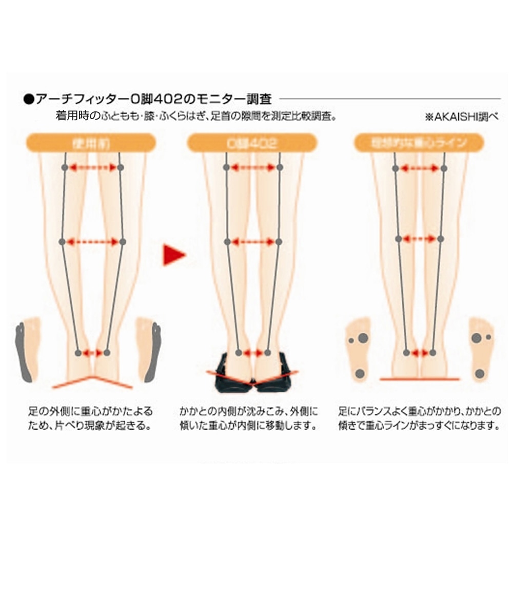 AKAISHI アーチフィッター406 O脚バックベルト 通販【ニッセン】