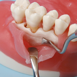 口腔外科実習用顎模型 [P15FE-OOP.1](FE咬合器つき)｜株式会社ニッシン