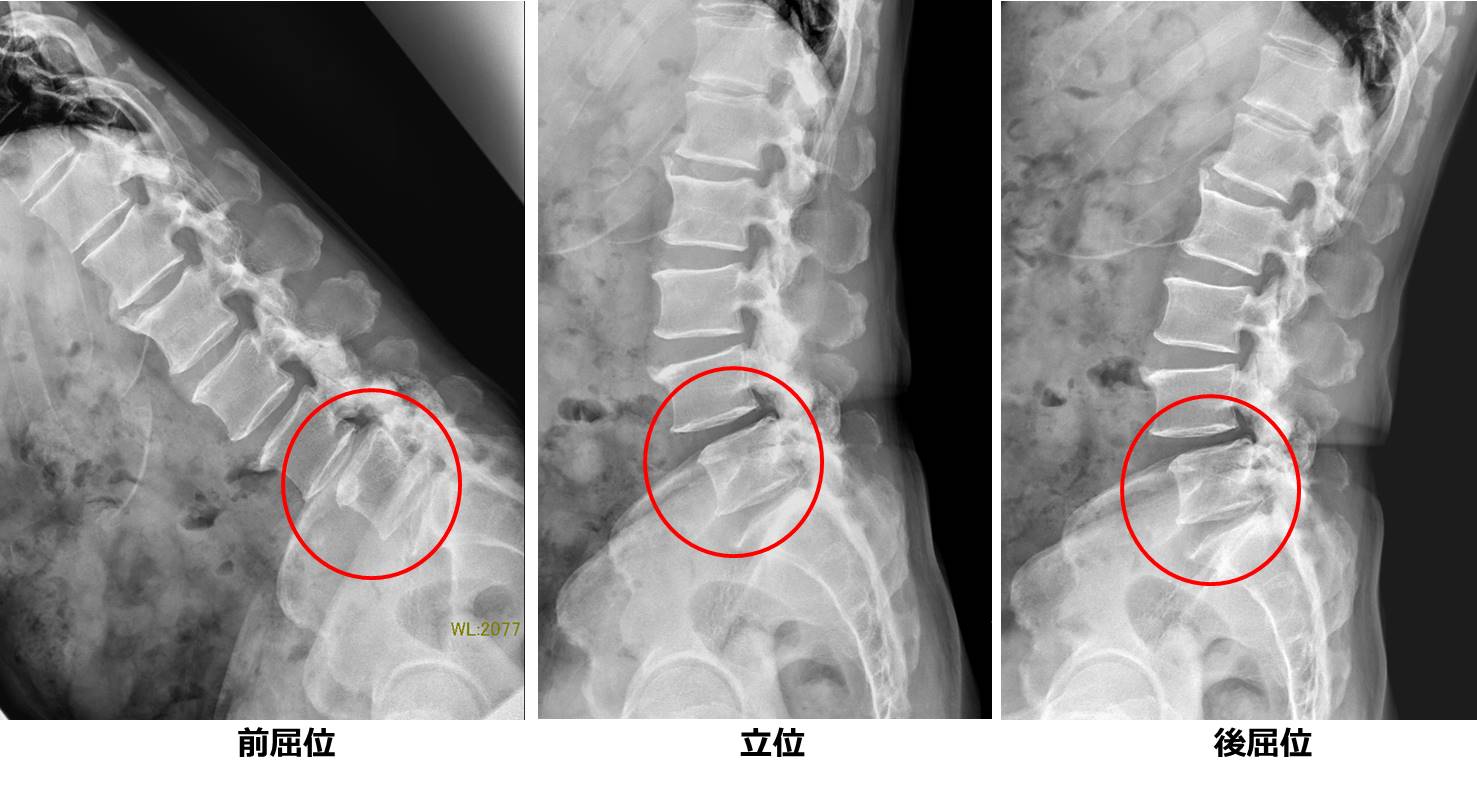 脊椎疾患の診察・治療・手術｜社会福祉法人恩賜財団 済生会滋賀県病院
