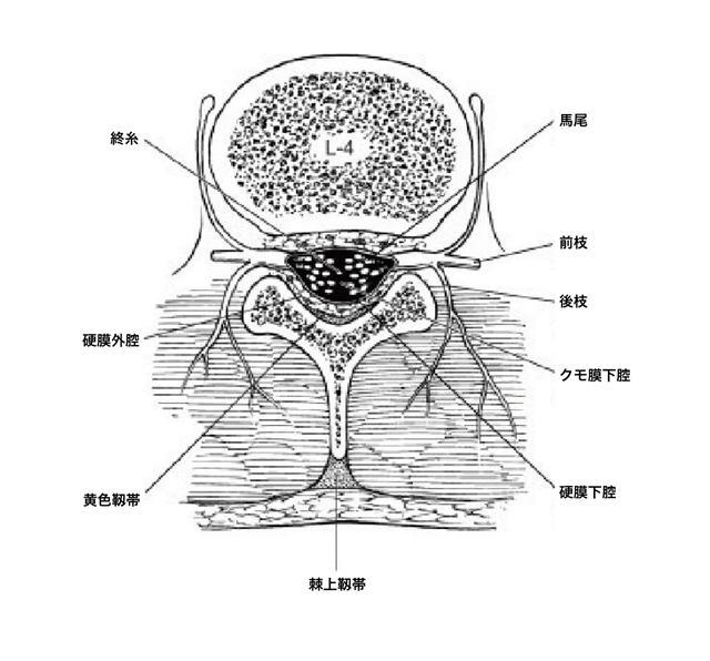 胸部硬膜外麻酔：正中アプローチ - Procedures Consult