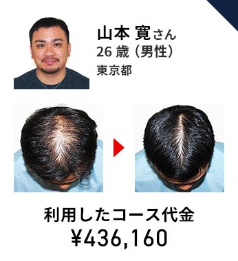 リーブ21の料金大公開！ | 薄毛対策・発毛専門のリーブ21