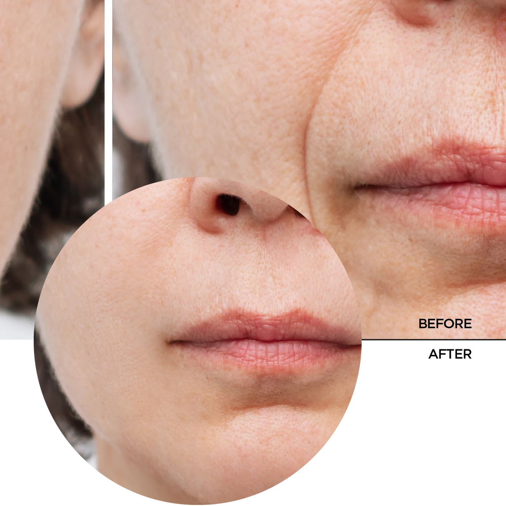 Peptides – Revox B77