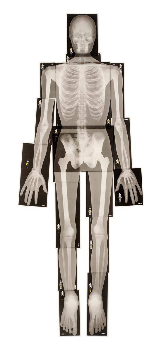 人体レントゲン写真セット XRAY－100【りかなび】ケニス株式会社