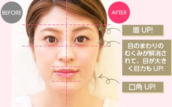 最強のホームエステ 美顔器『セルキュアスペシャル24』！！ | ブライダ