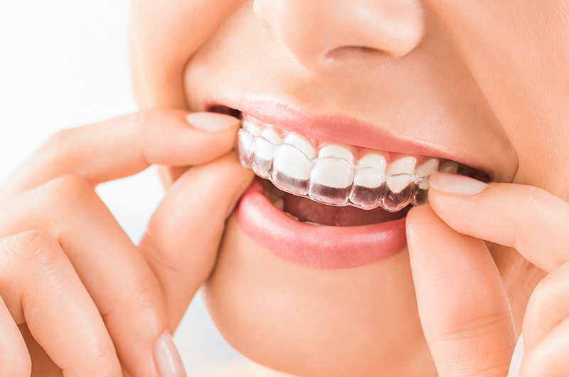 Our Orthodontic Treatments
